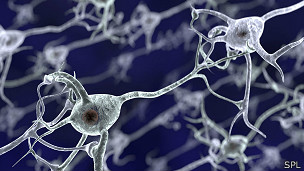 Los investigadores buscaron pequeñas protuberancias de células cerebrales llamadas espinas dendríticas.