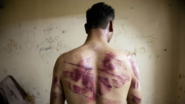 Las mujeres son sistemáticamente violadas por los guardias, según Amnistía Internacional. Otros métodos de tortura incluyen golpizas con barras de metal y choques eléctricos. Algunos prisioneros detenidos describieron cómo fueron obligados a contorsionar su cuerpo para caber en un neumático o recibieron latigazos en las plantas de los pies.