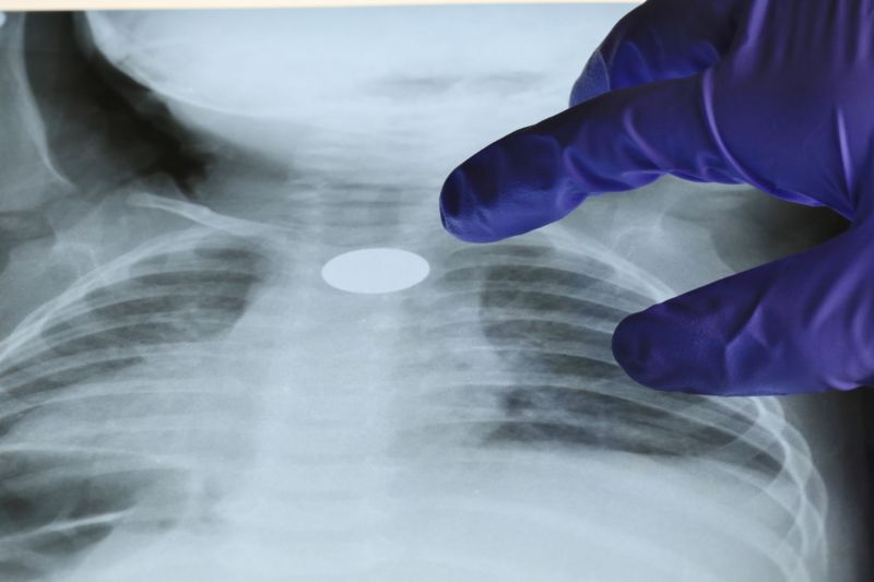 Los niños tienden a inhalar o ingerir todo tipo de objetos, con serios riesgos para la salud, incluyendo la muerte.