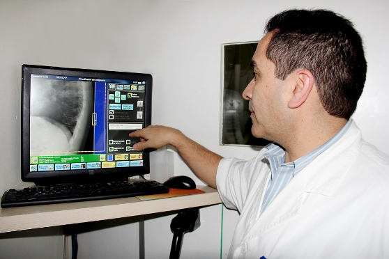 Hospital del Profesor optimiza su gestión con radiología digital de Carestream