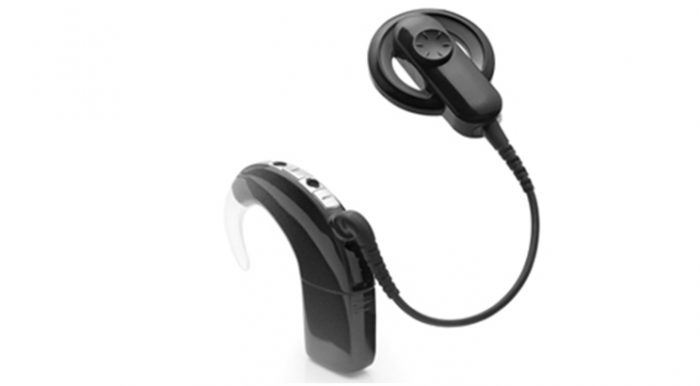 Una nueva tecnología para tratar la hipoacusia o pérdida auditiva