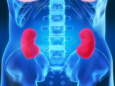 Consejos para prevenir la insuficiencia renal crónica