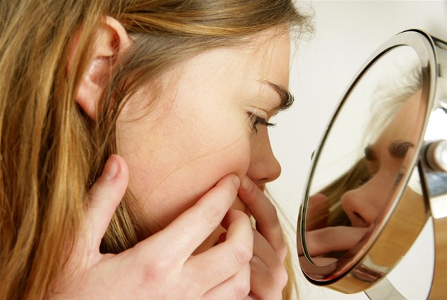 Lo que hay que saber para enfrentar el acné