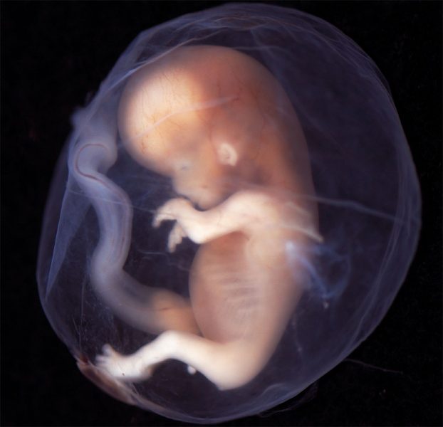 La prohibición del aborto como dique de contención