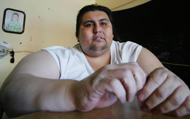 Fallece el mexicano que fue considerado el hombre más obeso del mundo