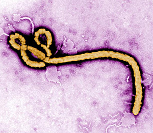 Vencer al ébola con anticuerpos y antibióticos