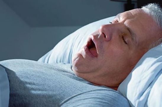 Todo lo que debes saber sobre el síndrome de apnea obstructiva del sueño