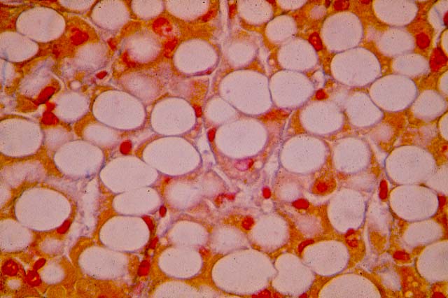 No toda la grasa es mala: estudio revela que la grasa repele a las bacterias