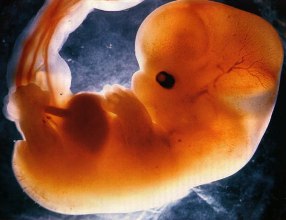 Sobre la decadencia intelectual del catolicismo en debate sobre el aborto: una breve respuesta a Eduardo Sabrovsky