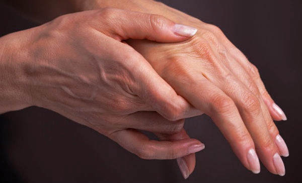 Desarrollan terapia con células humanas para combatir la artritis reumatoide