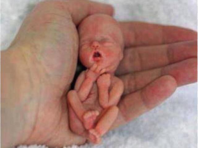 Foto de feto en gestación subida a Twitter por senadora Van Rysselberghe recibe rápido trolleo