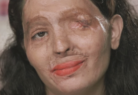[Video] ¿Cómo pintarnos los labios?: el tutorial de belleza para sensibilizar sobre ataques de ácido contra mujeres en India
