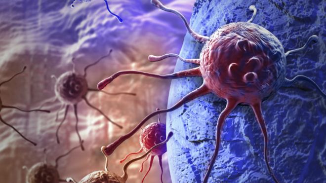 Las 118 cosas que se sabe producen cáncer (y la carne roja no es una de ellas)