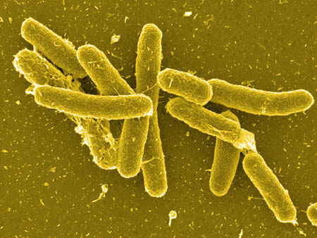 Uso de antibióticos contra la Salmonella podría provocar  daño crónico intestinal