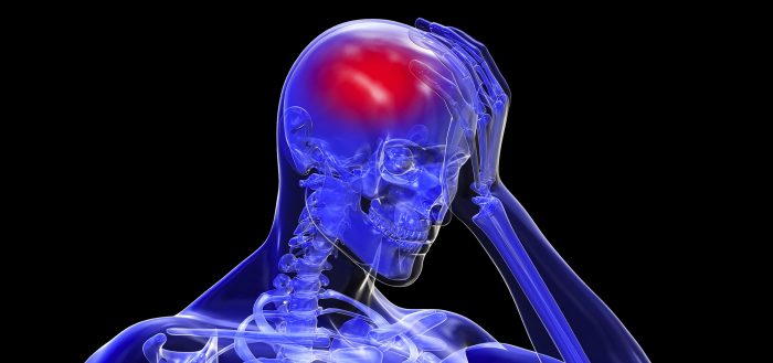 Investigan uso de antidepresivo como terapia en infartos cerebrales