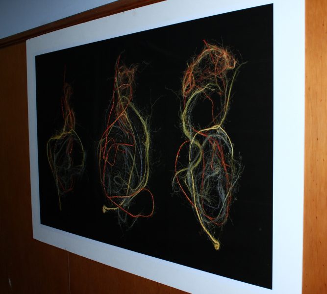 Exposición fotográfica “Neuronas: Redes Neuronales, Carreteras Cerebrales” de Francisco Stecher en Instituto de Neurocirugía, hasta el 11 de junio. Entrada liberada.