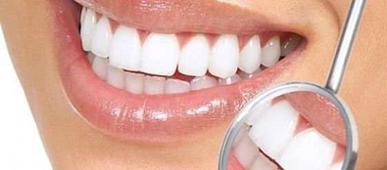 Lápices blanqueadores: peligros del aclaramiento dental en casa