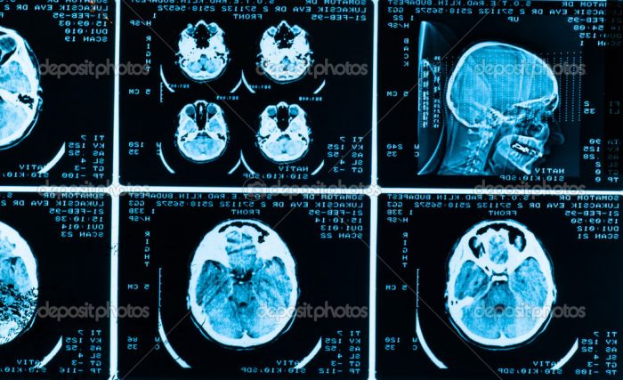 many type of brain scans with dark background