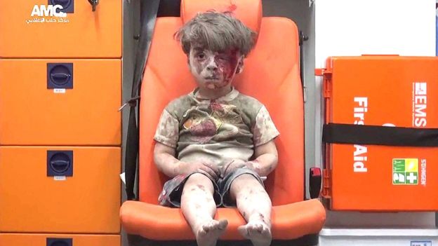 [VIDEO] Omran, el niño que se convirtió en un símbolo del horror en Siria