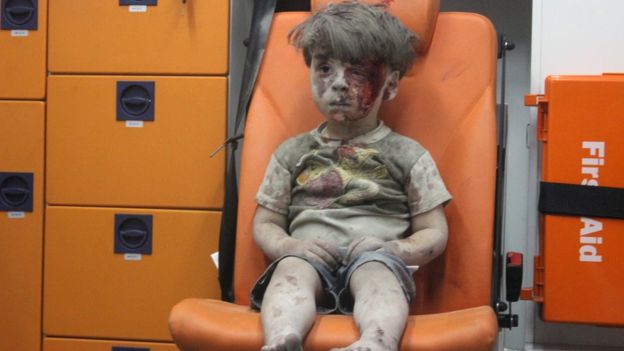 Alepo: la ciudad siria que se convirtió en un infierno para los niños