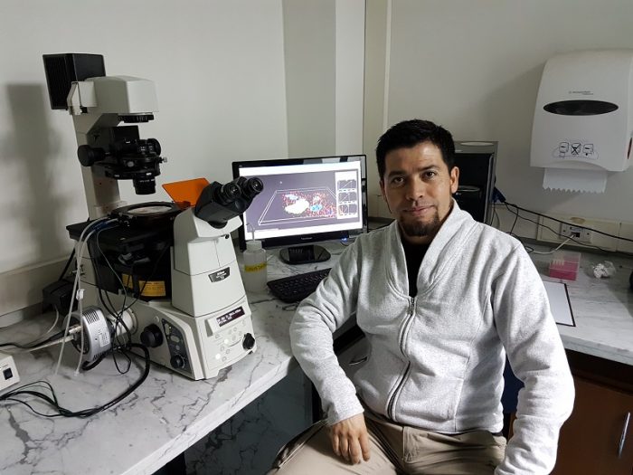 Científicos chilenos descubren rol de proteína en el desarrollo de metástasis