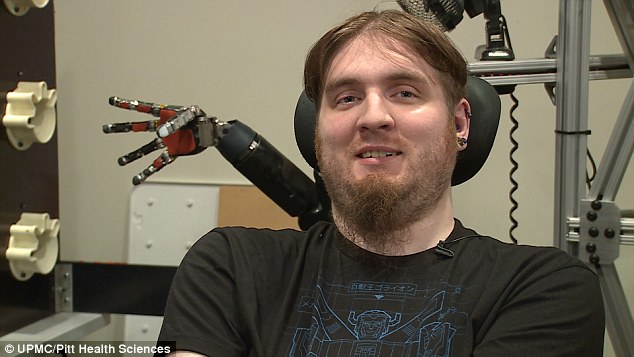 El implante cerebral y el brazo robótico que permitieron a un joven recuperar el tacto
