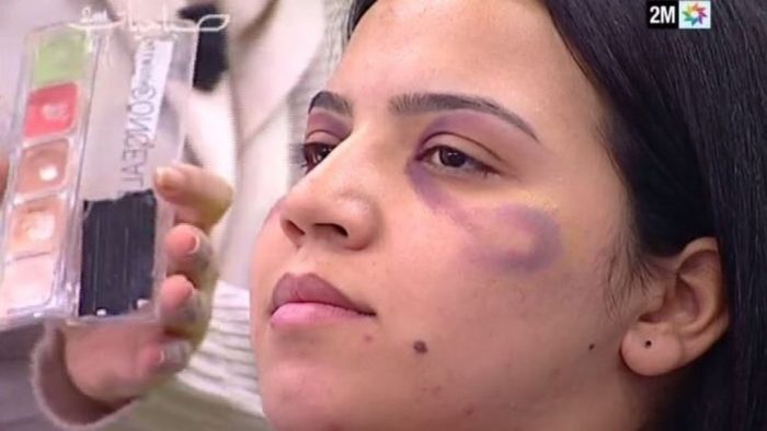[VIDEO] Marruecos: el polémico tutorial de un canal de televisión que enseña a mujeres a maquillarse los moretones provocados por golpes