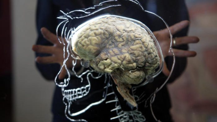 Hallazgos sobre conectividad cerebral permitirán ayudar a pacientes con demencias