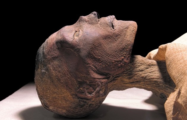 Viruela en momia del siglo XVII pone en duda la historia de esta enfermedad
