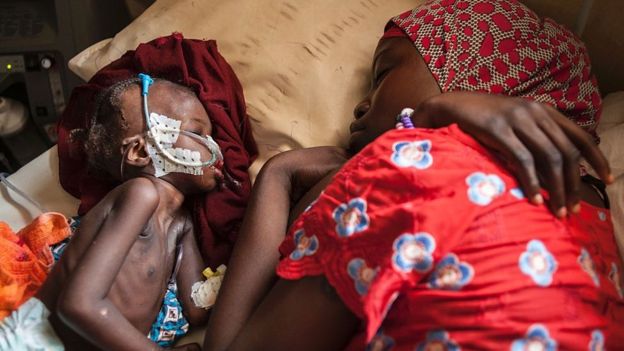 El drama de los niños de Nigeria: «Sobrevivimos al grupo islamista Boko Haram pero no a la hambruna»