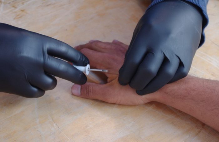 Una empresa belga implanta «chip» bajo la piel a ocho empleados voluntarios