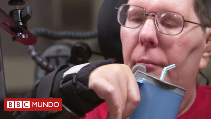 [VIDEO] El momento en que un hombre paralizado logró comer y beber sin ayuda gracias a implantes en su cerebro