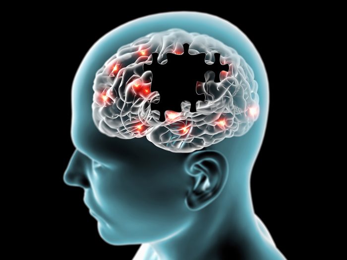 Con ejercicio de realidad virtual científicos estudian signos precoces del Alzheimer
