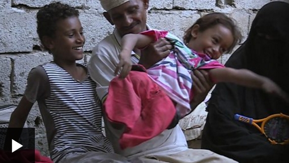 [VIDEO] Emad, el niño que se quedó sin piernas a los 4 años cuando un misil impactó en su casa de Yemen
