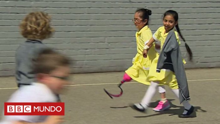 [VIDEO] El genial y tierno recibimiento a una niña que estrena pierna ortopédica en la escuela