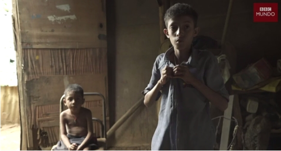 [VIDEO] Exclusivo BBC Mundo: las impactantes imágenes que muestran el drama de la severa desnutrición infantil en Venezuela
