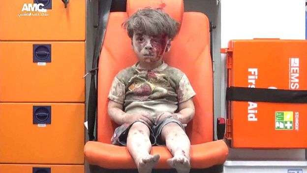 [VIDEO] Así luce hoy el niño que se convirtió en símbolo de la guerra en Siria