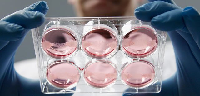 Las células madre, una opción para tratar más de 80 enfermedades
