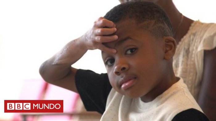 [VIDEO] La historia de Zion Harvey, el primer niño con un trasplante exitoso de manos (después de que su cuerpo las rechazara 8 veces)