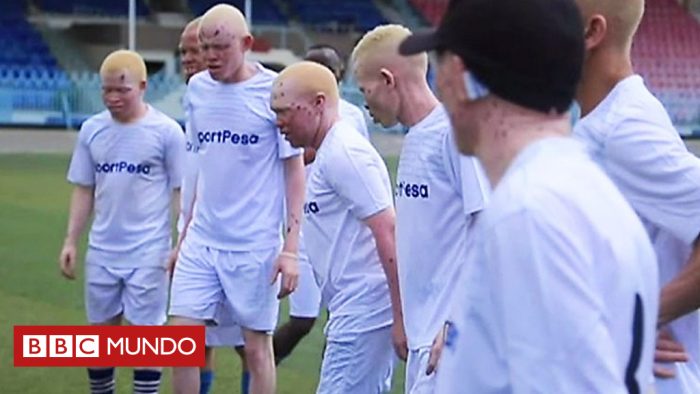 [VIDEO] Cómo la Liga Premier ayuda a combatir prejuicios raciales contra los albinos en África
