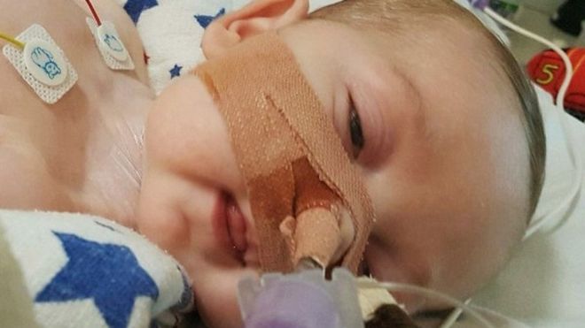 «Sentimos tanto no haberte podido salvar»: el bebé Charlie Gard pasa sus últimos momentos con sus padres antes de ser desconectado