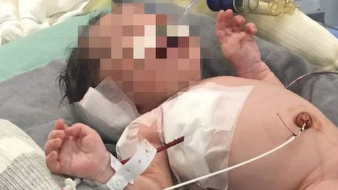 La increíble historia del bebé baleado en el útero de su madre que logró sobrevivir