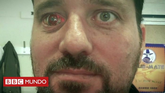 [VIDEO] Por qué instalé una cámara dentro de mi ojo: la historia de Rob Spence, el hombre que creó un «eyeborg»