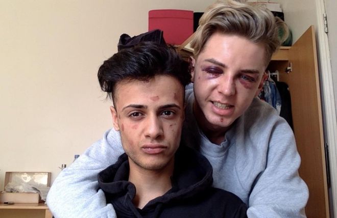 «Casi me dejaron ciego por escoger a la persona que amo»: el dramático relato de parejas gay que fueron brutalmente atacadas