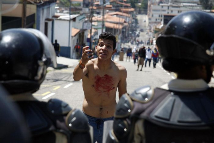 ONU denuncia tortura y el uso generalizado y sistemático de la fuerza excesiva en Venezuela