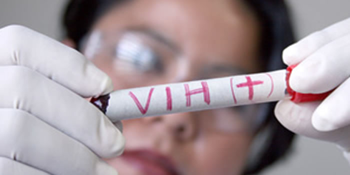 VIH también se dispara en sector privado: isapres registran mil casos nuevos por año