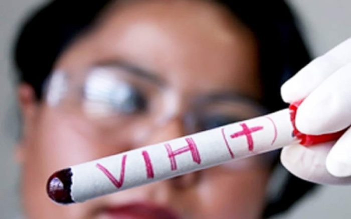 VIH Sida: más de 30 por ciento de los casos confirmados en enero de 2018 corresponden a inmigrantes