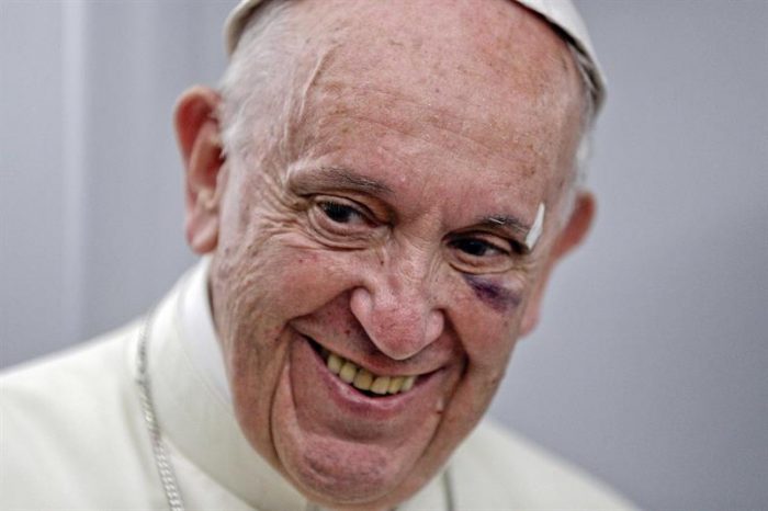 [VIDEO] Papa Francisco sufre chascarro en Colombia: es «atacado» por su propio auto