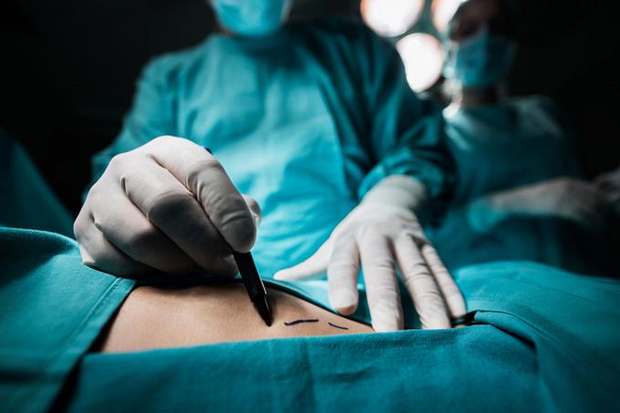 ¿Es la Cirugía Bariátrica la solución para la obesidad mórbida?