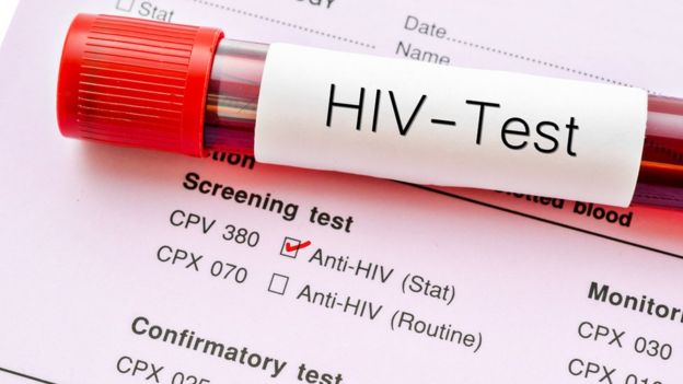 Superintendencia detectó 45 casos de incumplimiento en diagnóstico de VIH/Sida